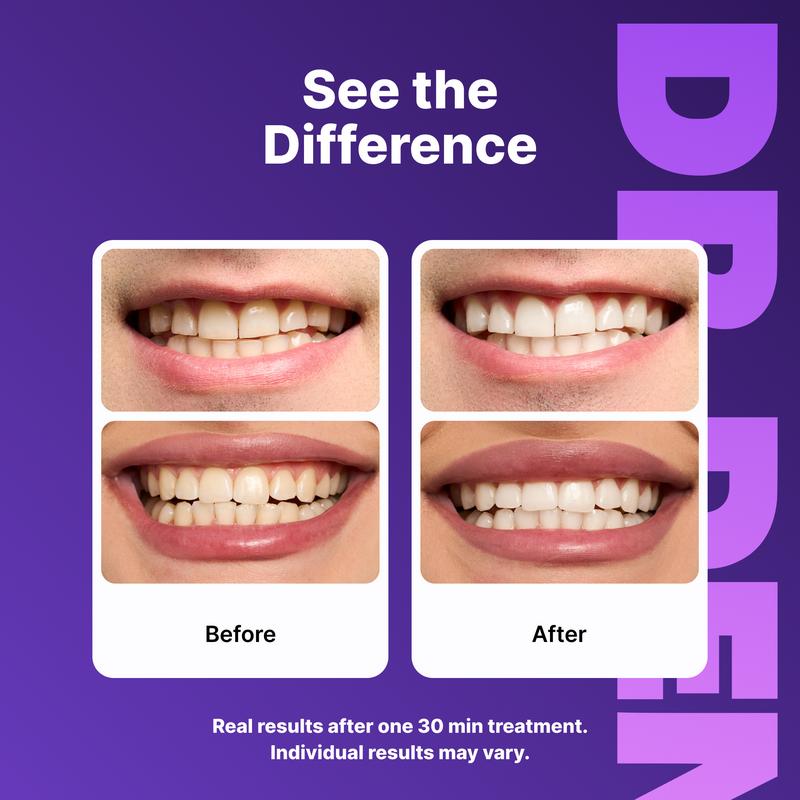 DR.DENT Purple Teeth Whitening Strips - 7/21 Whitening Sessions - Non Sensitive Teeth Whitening - Peroxide-Free